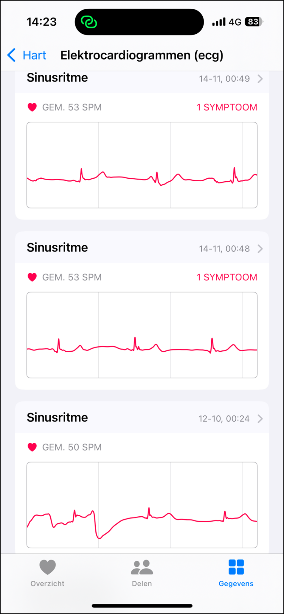 14 hart ecg 2